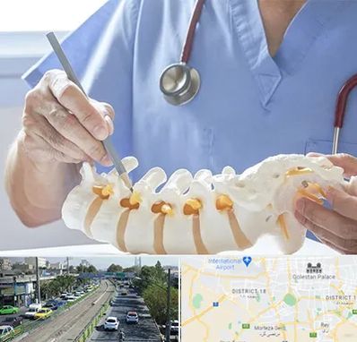 دکتر ستون فقرات در جنوب تهران 