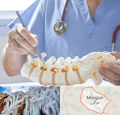 دکتر ستون فقرات در میگون