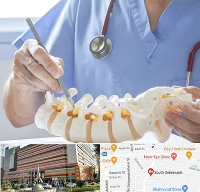 دکتر ستون فقرات در سهروردی 