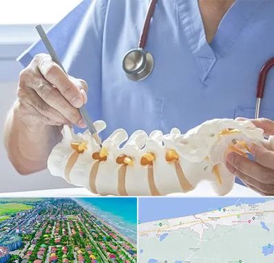 دکتر ستون فقرات در فریدونکنار