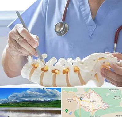 دکتر ستون فقرات در مرند