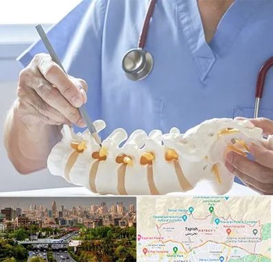 دکتر ستون فقرات در منطقه 1 تهران 