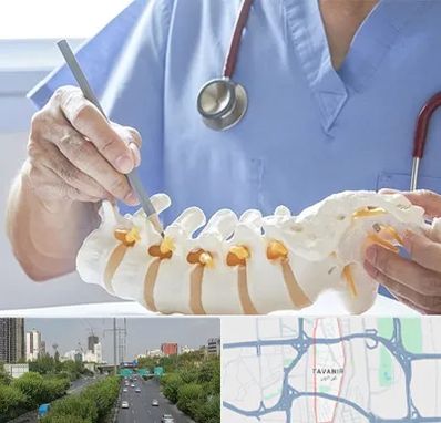 دکتر ستون فقرات در توانیر