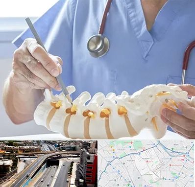 دکتر ستون فقرات در ستارخان شیراز 