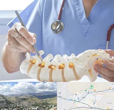 دکتر ستون فقرات در رودهن