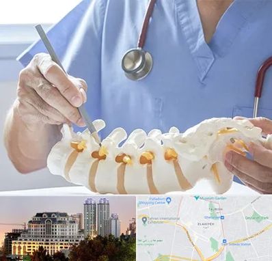 دکتر ستون فقرات در فرشته 