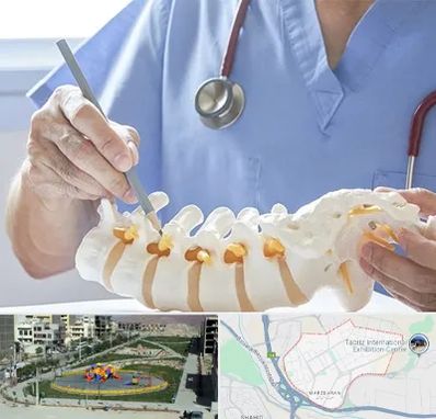 دکتر ستون فقرات در مرزداران تبریز