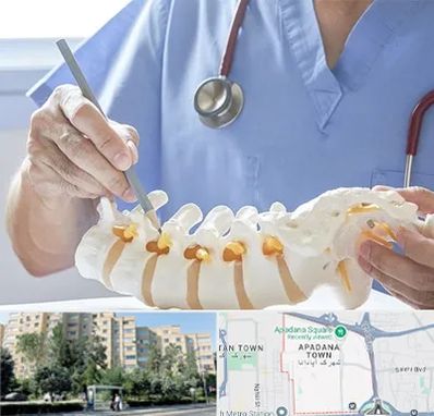 دکتر ستون فقرات در آپادانا