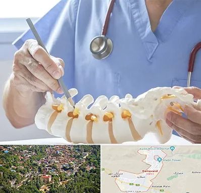 دکتر ستون فقرات در دماوند