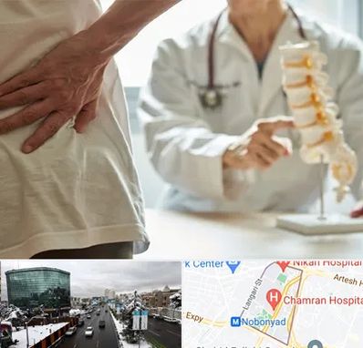 دکتر فوق تخصص ستون فقرات در اقدسیه 