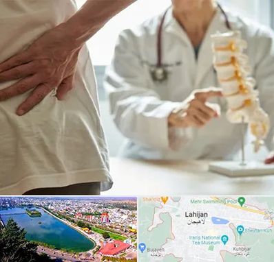 دکتر فوق تخصص ستون فقرات در لاهیجان