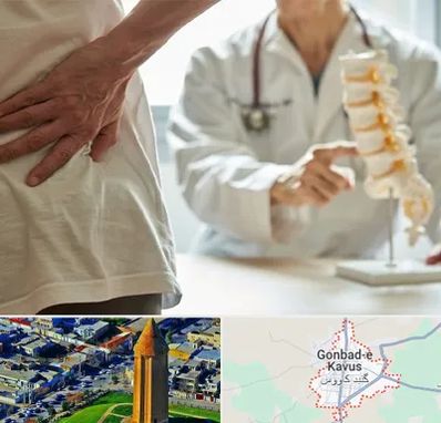 دکتر فوق تخصص ستون فقرات در گنبد کاووس