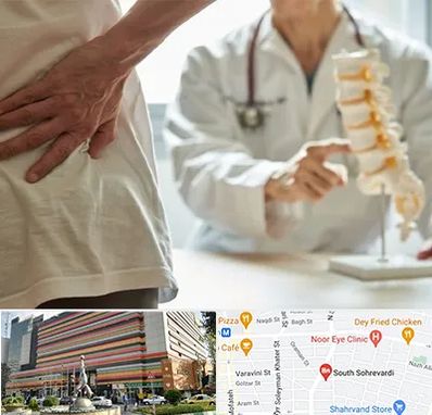 دکتر فوق تخصص ستون فقرات در سهروردی 