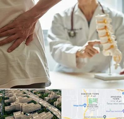 دکتر فوق تخصص ستون فقرات در اکباتان 