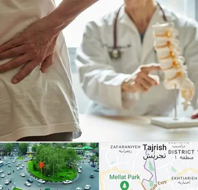 دکتر فوق تخصص ستون فقرات در تجریش 