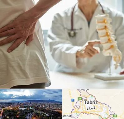 دکتر فوق تخصص ستون فقرات در تبریز