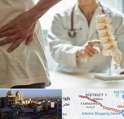 دکتر فوق تخصص ستون فقرات در فرمانیه 