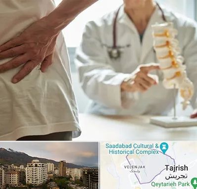 دکتر فوق تخصص ستون فقرات در زعفرانیه 