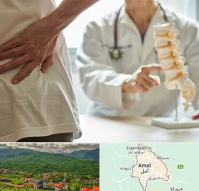 دکتر فوق تخصص ستون فقرات در آمل