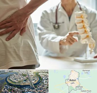 دکتر فوق تخصص ستون فقرات در بابل