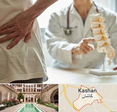 دکتر فوق تخصص ستون فقرات در کاشان