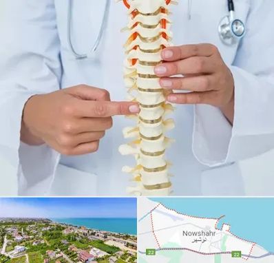جراح ستون فقرات در نوشهر