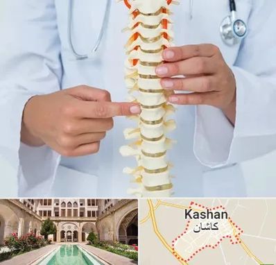 جراح ستون فقرات در کاشان