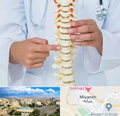 جراح ستون فقرات در میانه