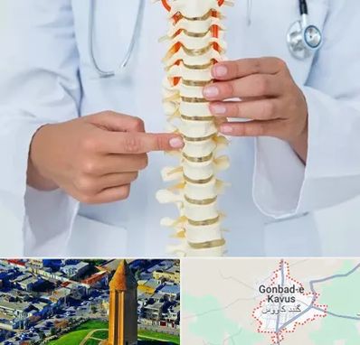 جراح ستون فقرات در گنبد کاووس