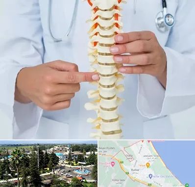 جراح ستون فقرات در رودسر