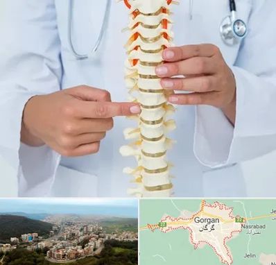جراح ستون فقرات در گرگان