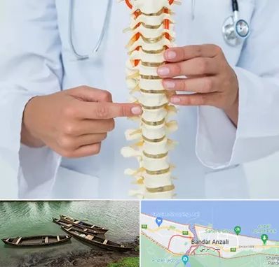 جراح ستون فقرات در بندر انزلی