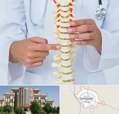 جراح ستون فقرات در دهدشت