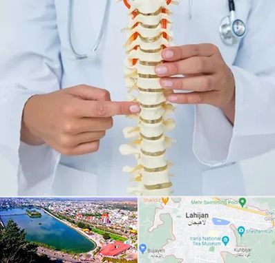 جراح ستون فقرات در لاهیجان