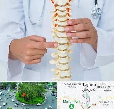 جراح ستون فقرات در تجریش 