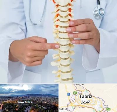 جراح ستون فقرات در تبریز