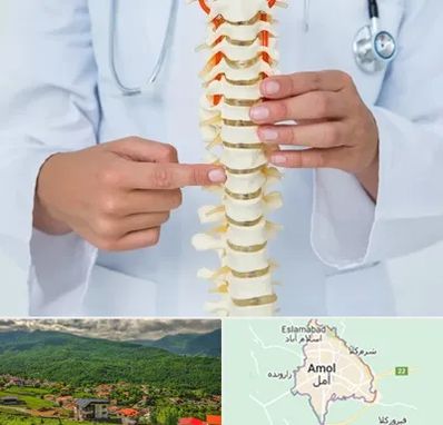 جراح ستون فقرات در آمل
