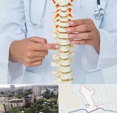 جراح ستون فقرات در اوین