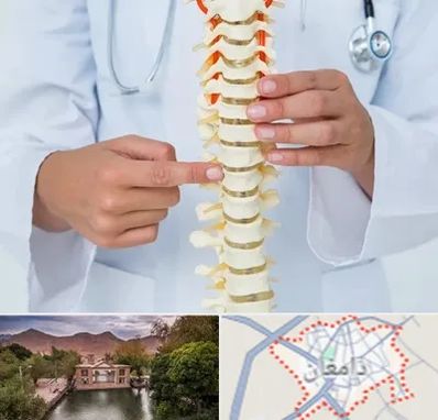جراح ستون فقرات در دامغان