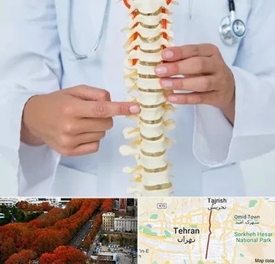 جراح ستون فقرات در ولیعصر 