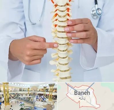 جراح ستون فقرات در بانه