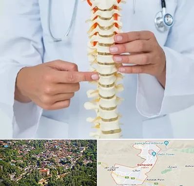 جراح ستون فقرات در دماوند