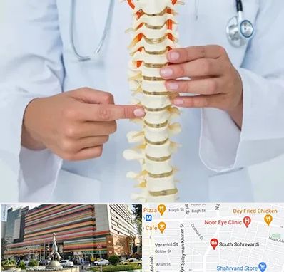 جراح ستون فقرات در سهروردی 