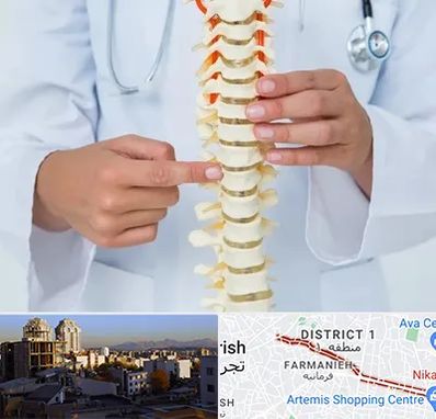 جراح ستون فقرات در فرمانیه 