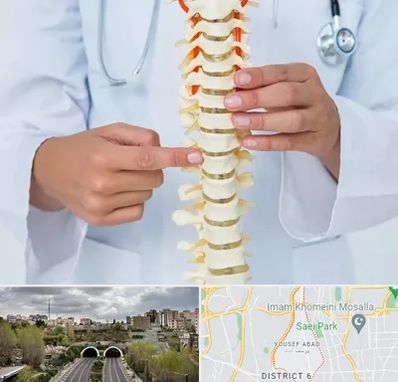 جراح ستون فقرات در یوسف آباد 