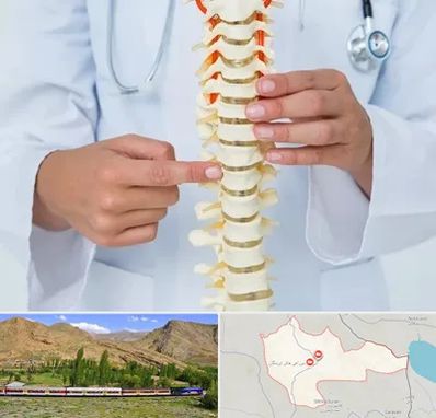 جراح ستون فقرات در خاش