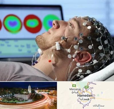 مرکز نوار مغز در همدان