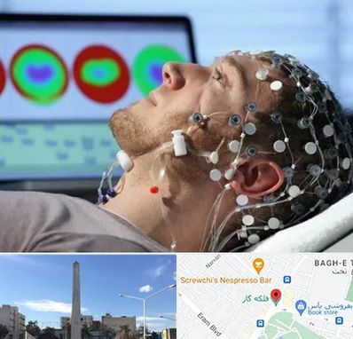 مرکز نوار مغز در فلکه گاز شیراز 