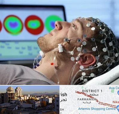 مرکز نوار مغز در فرمانیه 