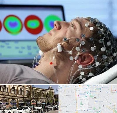 مرکز نوار مغز در منطقه 11 تهران 